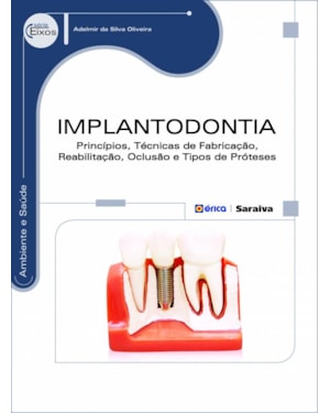 IMPLANTODONTIA: PRINCÍPIOS, TÉCNICAS DE FABRICAÇÃO, REABILITAÇÃO, OCLUSÃO E TIPOS DE PRÓTESES