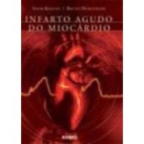 INFARTO AGUDO DO MIOCARDIO
