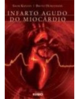 Infarto agudo do miocárdio