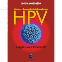 INFECÇÕES E DOENÇAS GENITAIS CAUSADAS POR HPV: DIAGNÓSTICO E TRATAMENTO
