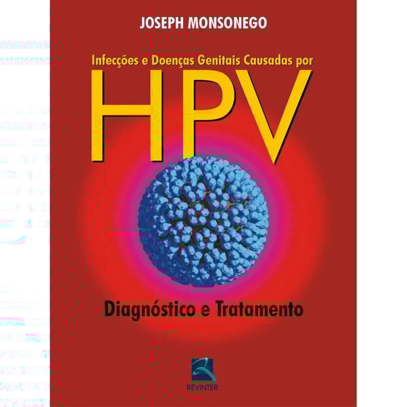 INFECÇÕES E DOENÇAS GENITAIS CAUSADAS POR HPV: DIAGNÓSTICO E TRATAMENTO