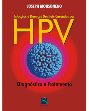 Infecções e doenças genitais causadas por HPV: diagnóstico e tratamento