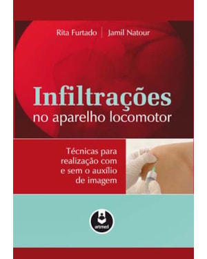 INFILTRAÇÕES DO APARELHO LOCOMOTOR: TÉCNICAS PARA REALIZAÇÃO COM E SEM O AUXÍLIO DE IMAGEM