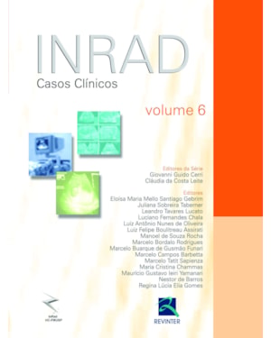 INRAD: casos clínicos