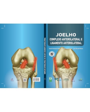 JOELHO : COMPLEXO ANTEROLATERAL E LIGAMENTO ANTEROLATERAL