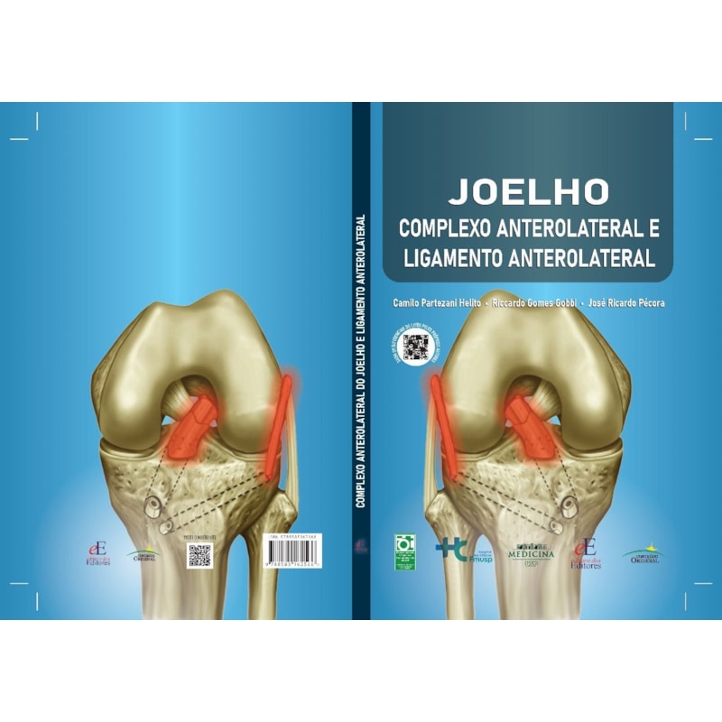 JOELHO : COMPLEXO ANTEROLATERAL E LIGAMENTO ANTEROLATERAL