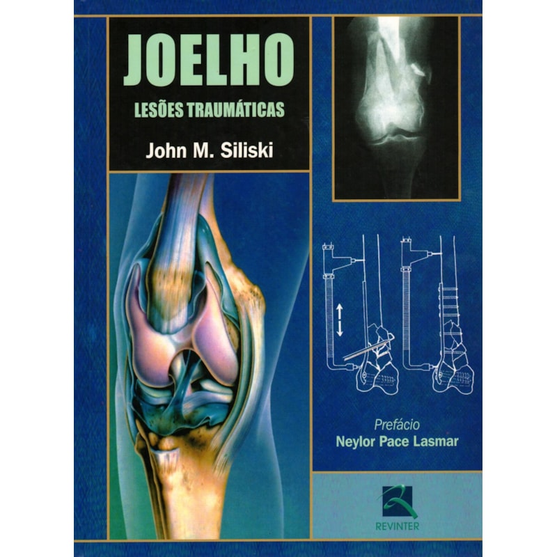JOELHO: LESÕES TRAUMÁTICAS
