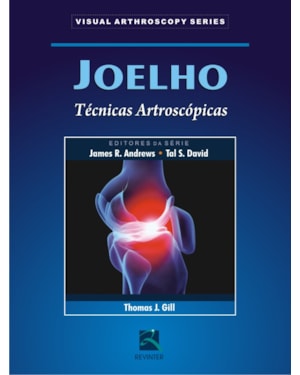Joelho: técnicas artroscópicas