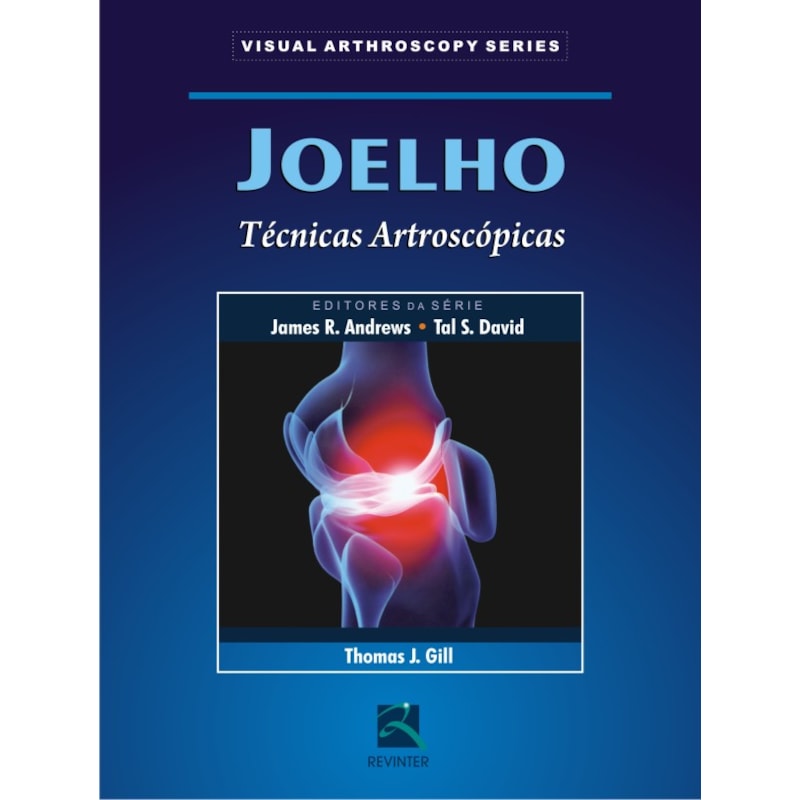 JOELHO: TÉCNICAS ARTROSCÓPICAS