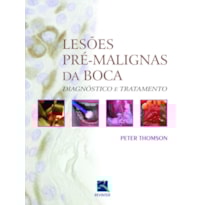 LESÕES PRÉ: MALÍGNAS DA BOCA