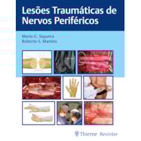 LESÕES TRAUMÁTICAS DE NERVOS PERIFÉRICOS
