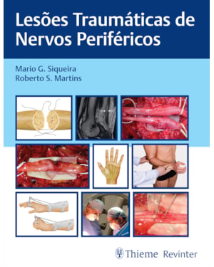 Lesões traumáticas de nervos periféricos