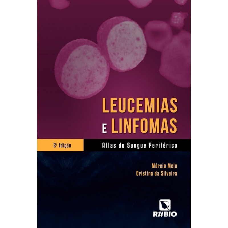 LEUCEMIAS E LINFOMAS - ATLAS DO SANGUE PERIFERICO - 2