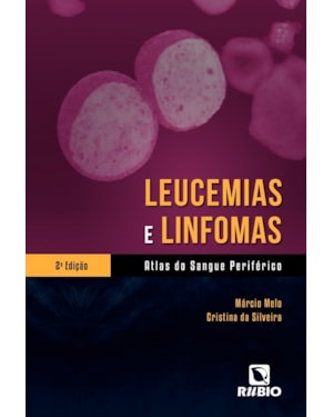 Leucemias e linfomas: Atlas do sangue periférico