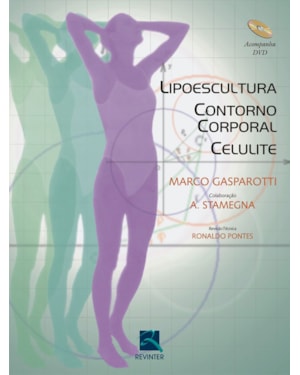 Lipoescultura, contorno corporal, celulite