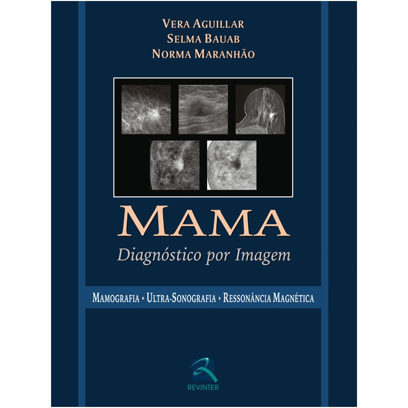 MAMA: DIAGNÓSTICO POR IMAGEM