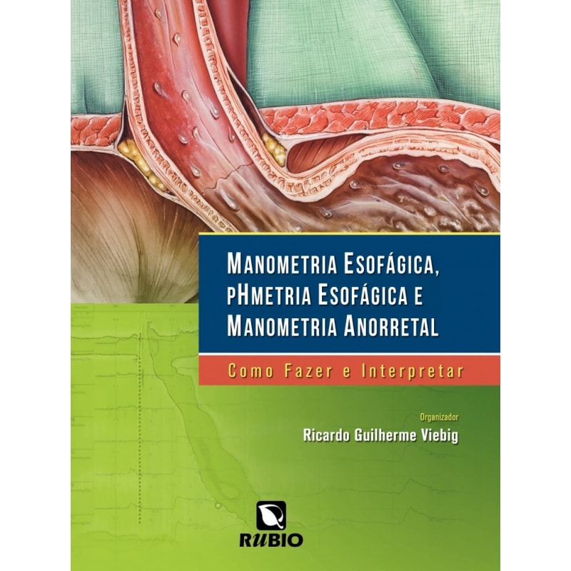 MANOMETRIA ESOFAGICA, PHMETRIA ESOFAGICA E MANOMETRIA ANORRETAL: COMO FAZER - 1