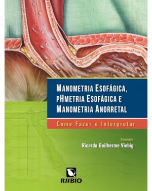 Manometria esofágica, phmetria esofágica e manometria anorretal: Como fazer e interpretar