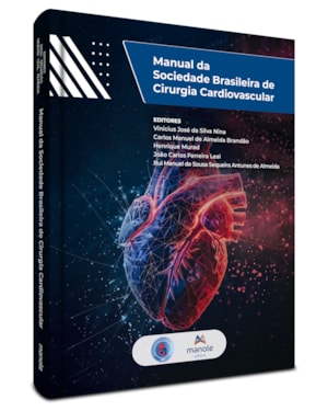 Manual da sociedade brasileira de cirurgia cardiovascular