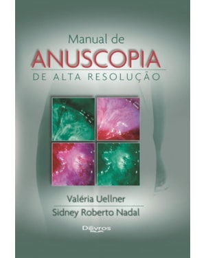MANUAL DE ANUSCOPIA DE ALTA RESOLUÇÃO