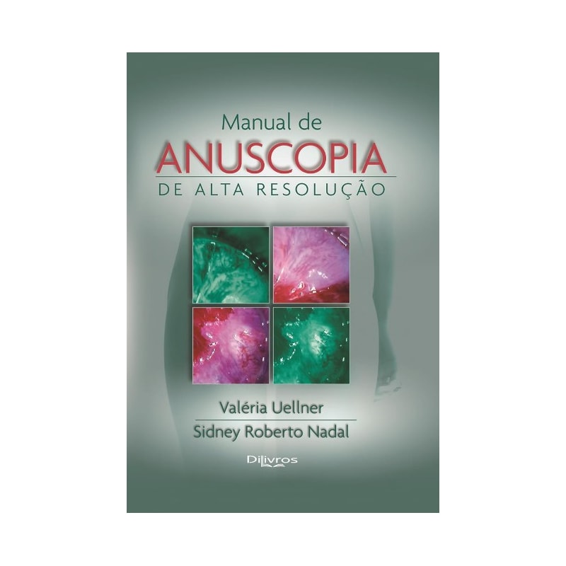 MANUAL DE ANUSCOPIA DE ALTA RESOLUÇÃO