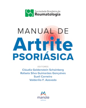 Manual de artrite psoriásica: diagnóstico e tratamento