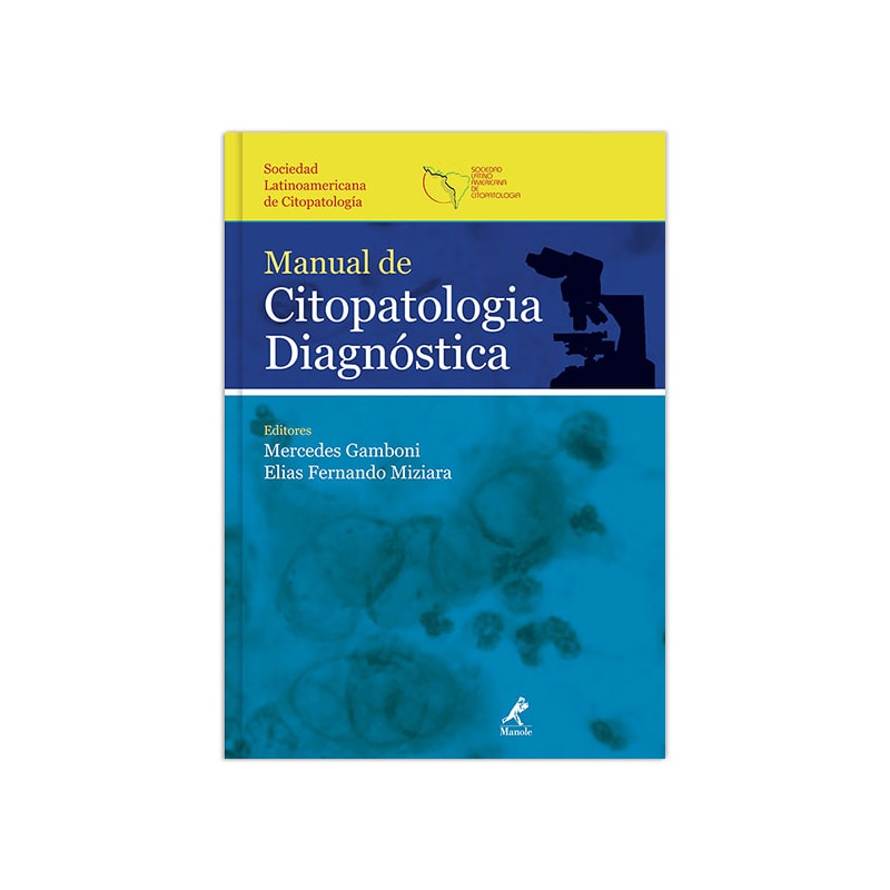 MANUAL DE CITOPATOLOGIA DIAGNÓSTICA: SOCIEDAD LATINOAMERICANA DE CITOPATOLOGIA