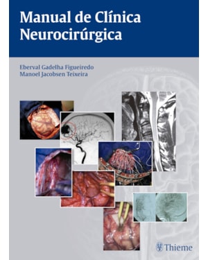 Manual de clínica neurocirúrgica