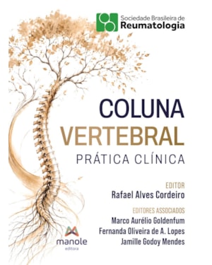 Manual de coluna vertebral: Abordagem clínica