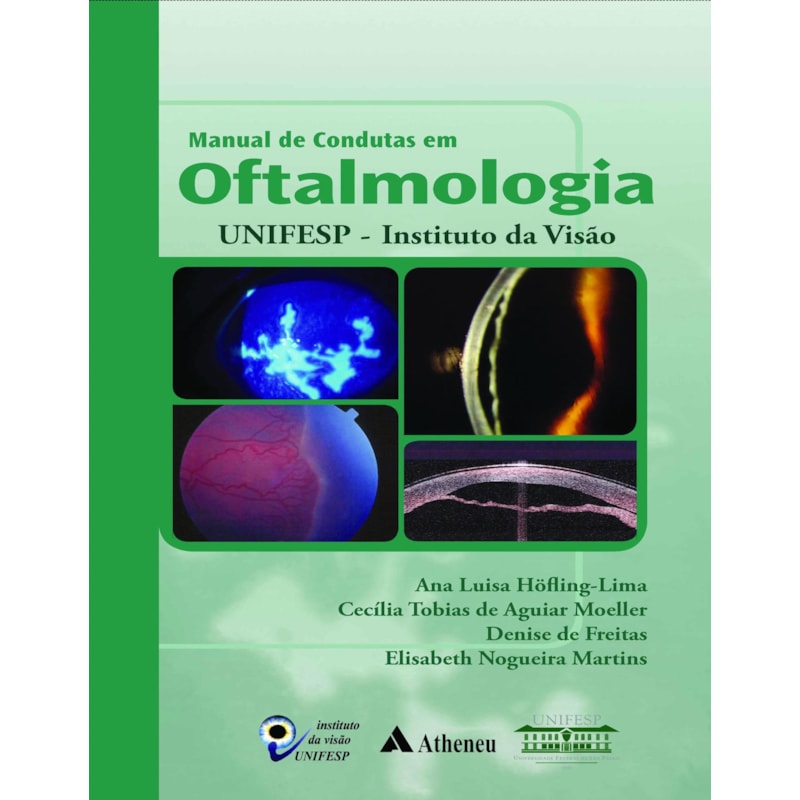 MANUAL DE CONDUTAS EM OFTALMOLOGIA UNIFESP - INSTITUTO DA VISÃO