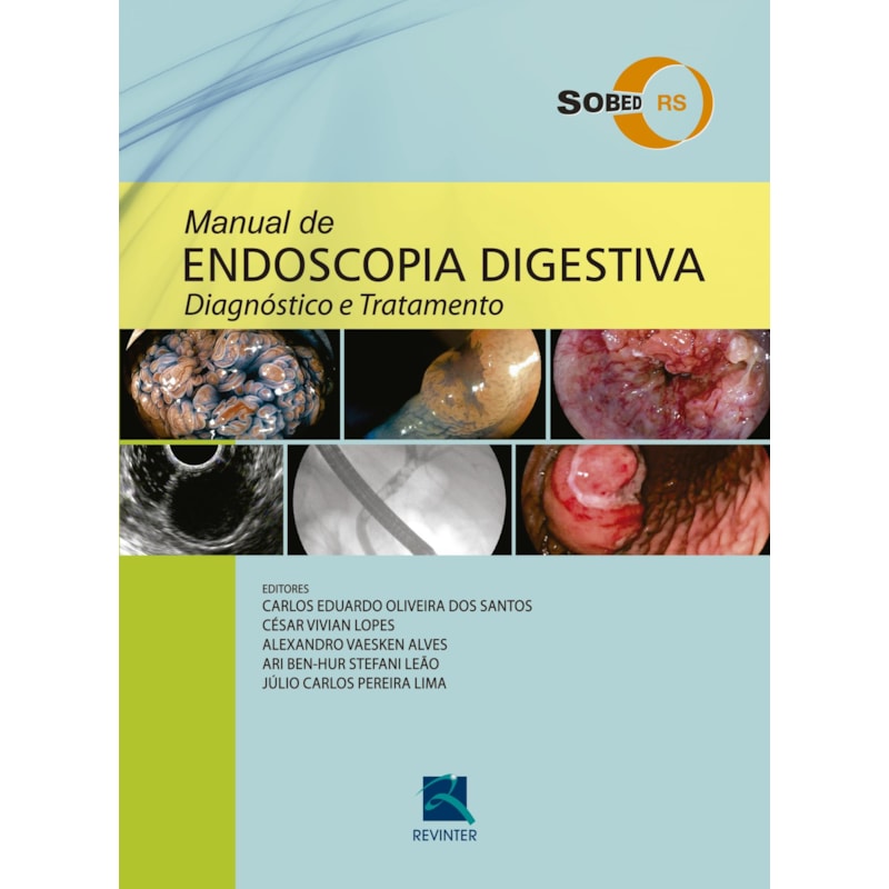 Manual de Endoscopia Digestiva: Diagnóstico e Tratamento