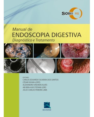 Manual de Endoscopia Digestiva: Diagnóstico e Tratamento