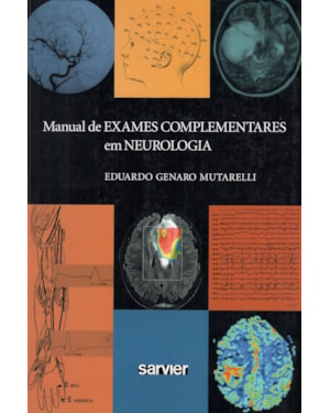 MANUAL DE EXAMES COMPLEMENTARES EM NEUROLOGIA
