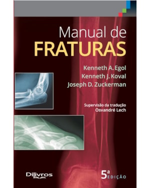 MANUAL DE FRATURAS