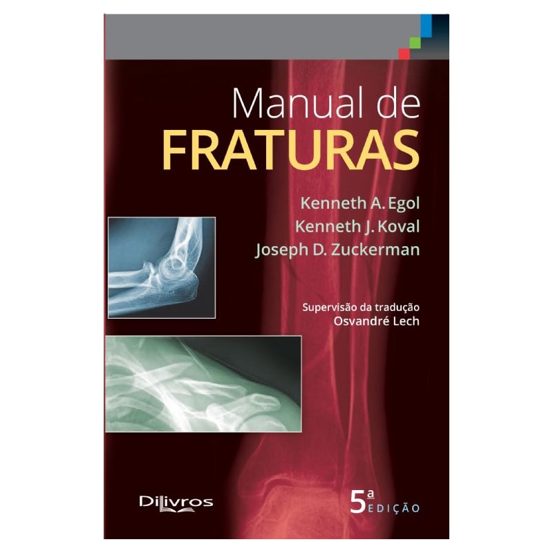 MANUAL DE FRATURAS