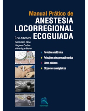Manual Prático de Anestesia Locorregional Ecoguiada