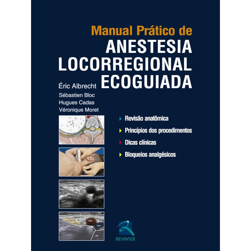 MANUAL PRÁTICO DE ANESTESIA LOCORREGIONAL ECOGUIADA