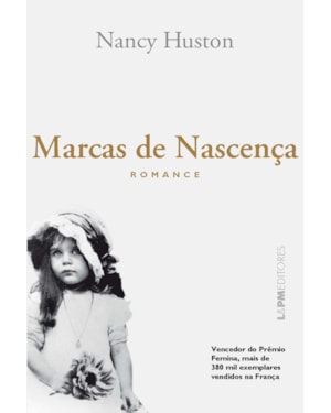 Marcas de nascença