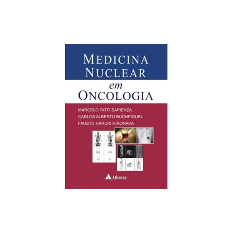 MEDICINA NUCLEAR EM ONCOLOGIA