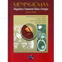 Meningiomas: diagnóstico e tratamento clínico e cirúrgico - Aspectos atuais