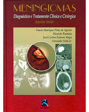 Meningiomas: diagnóstico e tratamento clínico e cirúrgico - Aspectos atuais