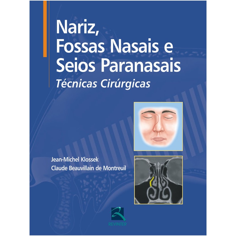 NARIZ, FOSSAS NASAIS E SEIOS PARANASAIS: TÉCNICAS CIRÚRGICAS