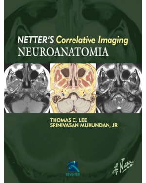 Netter''''s Correlative Imaging - Neuroanatomia