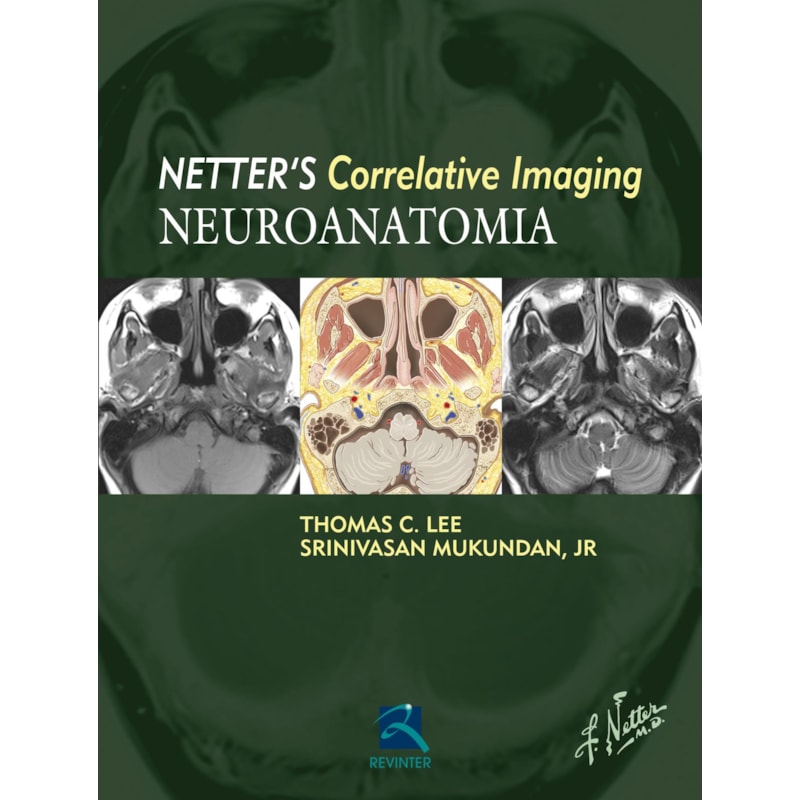 Netter''''s Correlative Imaging - Neuroanatomia