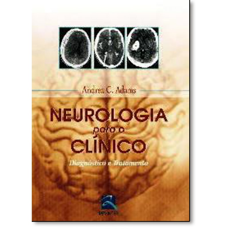 NEUROLOGIA PARA O CLÍNICO: DIAGNÓSTICO E TRATAMENTO