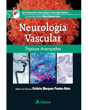 Neurologia vascular: tópicos avançados