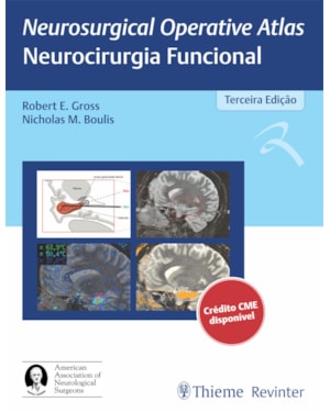 Neurosurgical operative atlas - Neurocirurgia funcional