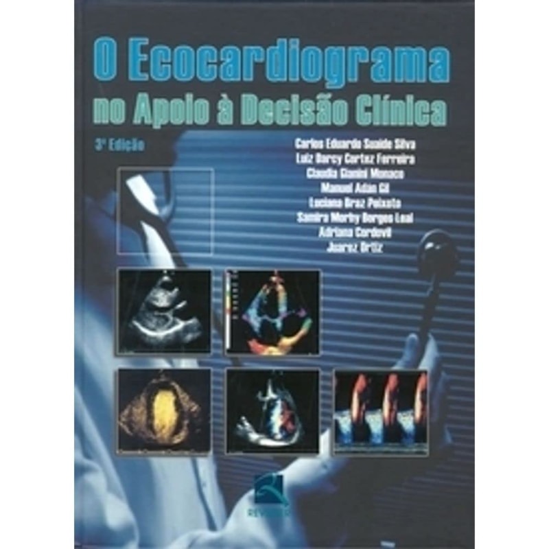 O ECOCARDIOGRAMA NO APOIO À DECISAO CLÍNICA