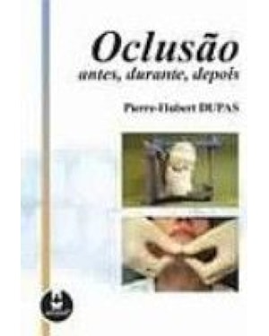 OCLUSAO, ANTES, DURANTE, DEPOIS