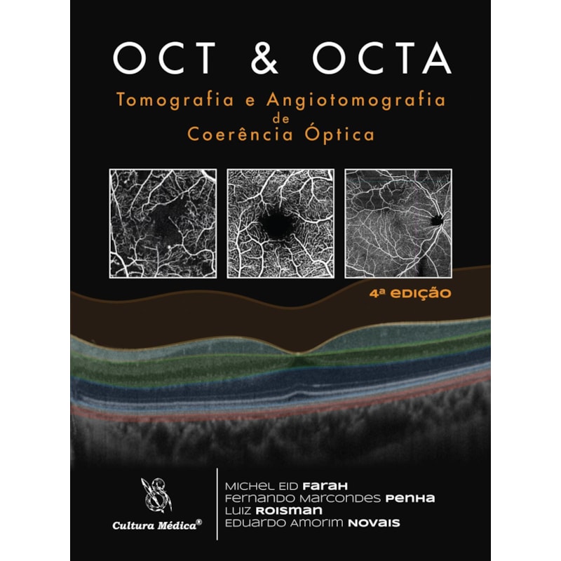 OCT & OCTA TOMOGRAFIA E ANGIOTOMOGRAFIA DE COERÊNCIA ÓPTICA - 4. EDIÇÃO